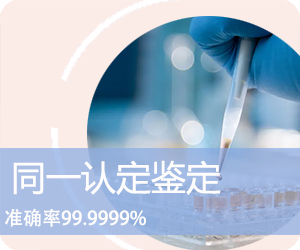 玉溪DNA同一认定