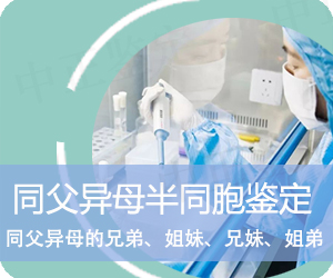 玉溪同父异母半同胞鉴定