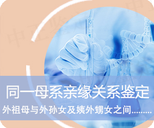 玉溪同一母系亲缘关系鉴定